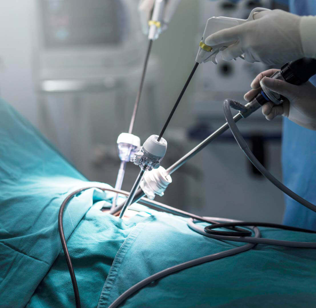 Bariatric & Laparoscopic Surgery